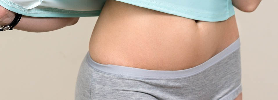 Abdominoplastia