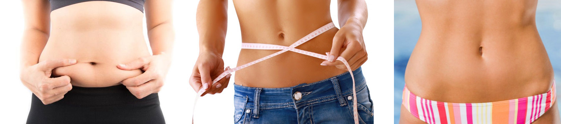 tummy tuck new york